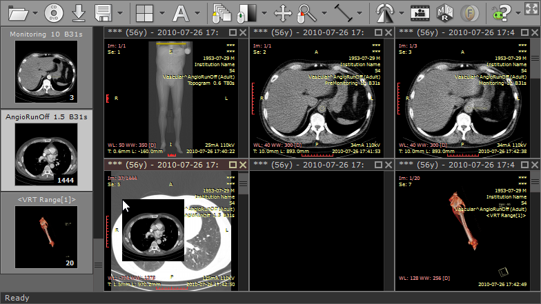 radiant dicom viewer