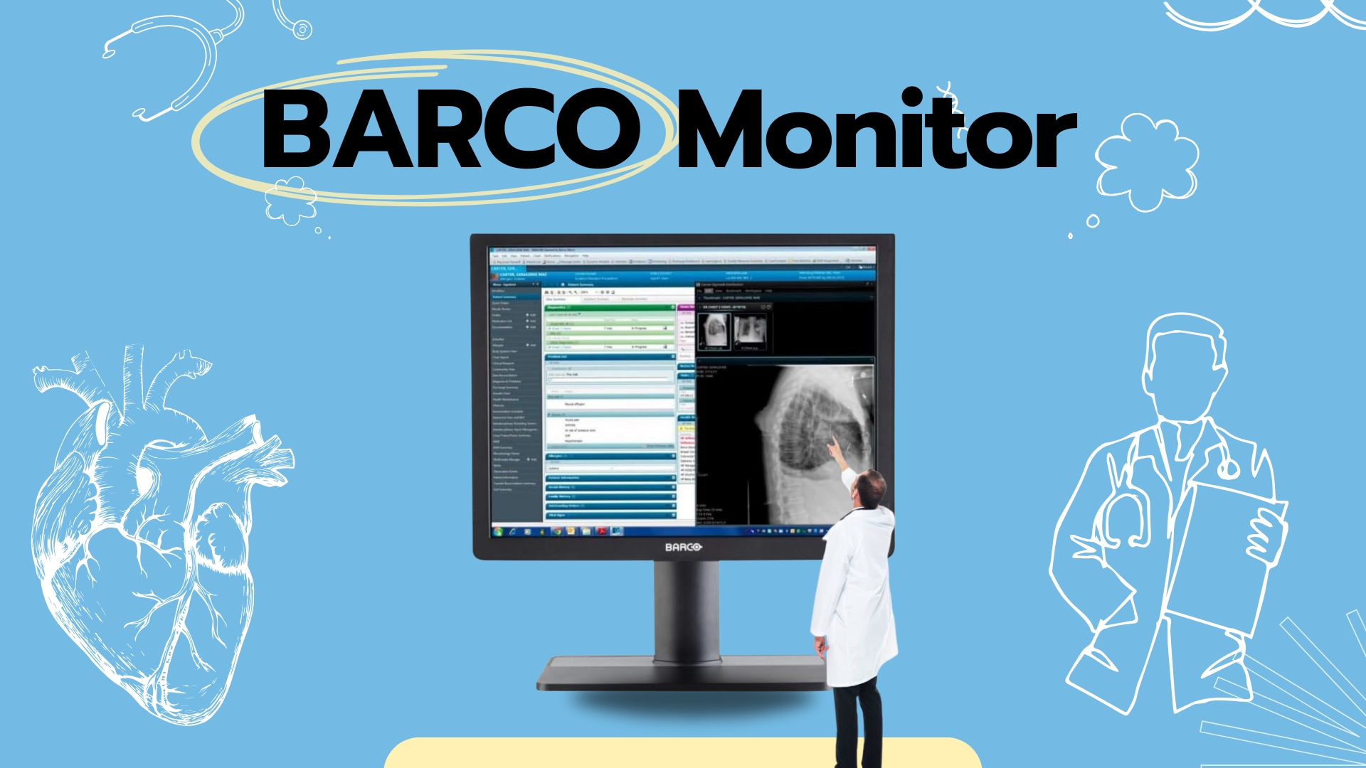 Barco Monitor