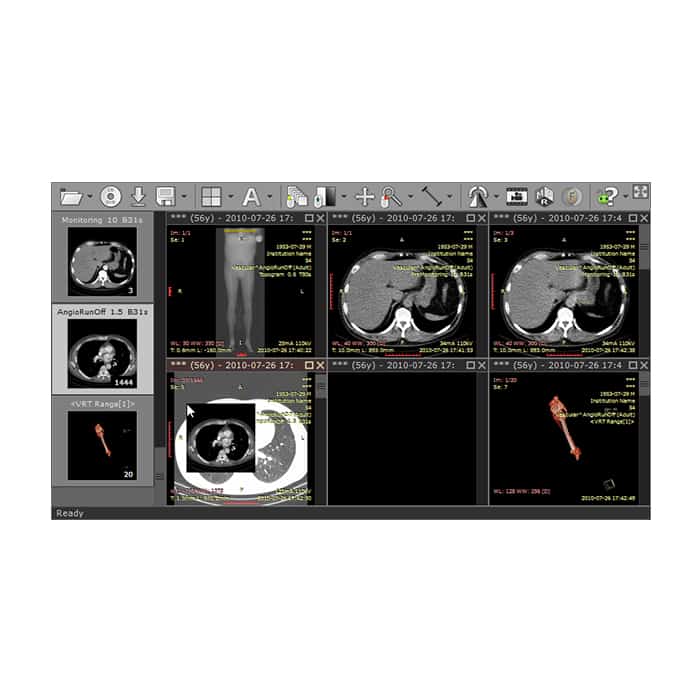 RadiAnt Dicom Viewer